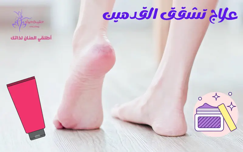 علاج تشقق القدمين